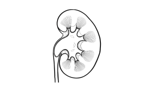 Liver Transplant (4) Liver Transplant (4)
