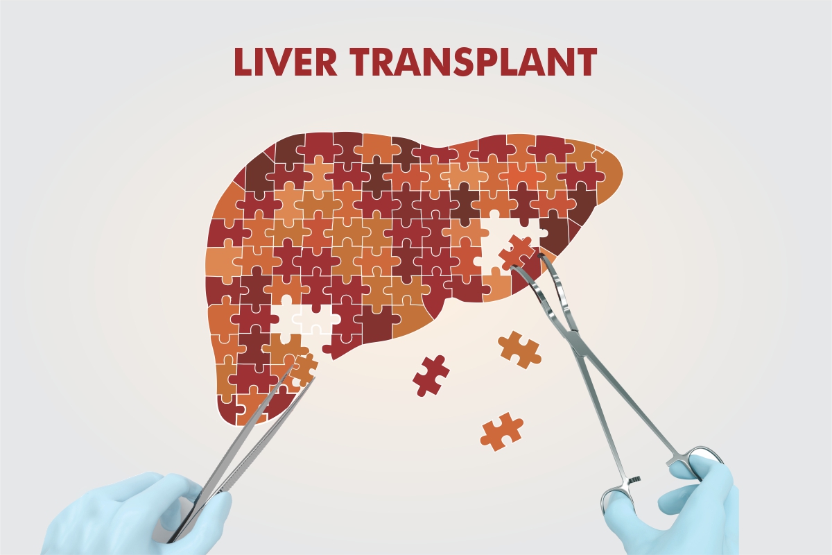 Liver Transplant in Pakistan